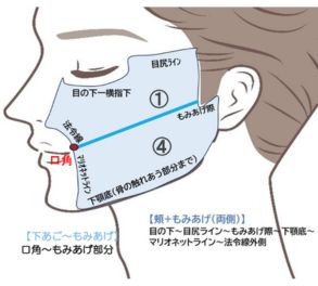 パーツ別脱毛