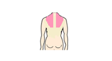 施術部位イラスト